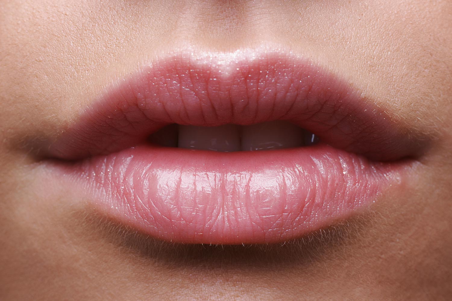 Lippenvergrößerung mit Hyaluronsäure in Starnberg