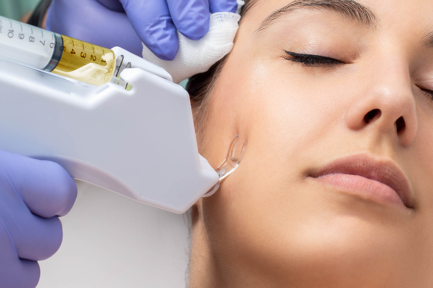 Mesotherapie für eine effektive natürliche Behandlung von Gesicht, Haare und Körper